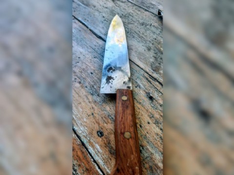 Violento ataque con cuchillo en la madrugada: un hombre terminó con heridas graves y el agresor sigue prófugo