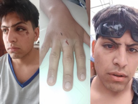 VIDEO | Brutal pelea a la salida de un boliche deja a dos hermanos gravemente golpeados: la madre exige respuestas