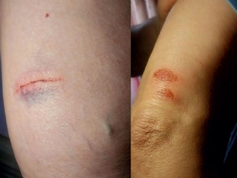 VIDEO | "Prefería morir yo antes que mis hijos": el dramático testimonio del padre que sirvió de escudo en Nehuenche