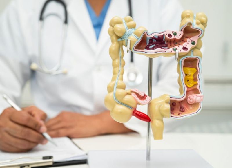Continúa la campaña de detección temprana del cáncer de colon impulsada por Lalcec y Salud